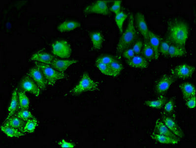 Smn1 Polyclonal Antibody - image 4