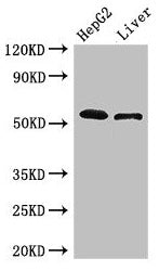 Immunohistochemistry of paraffin-embedded human colon cancer using CAC07916 at dilution of 1:100