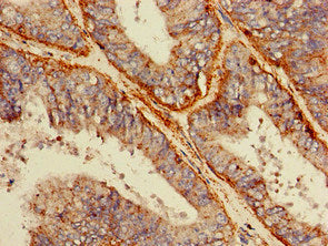 Immunofluorescent analysis of HepG2 cells using CAC07916 at dilution of 1:100 and Alexa Fluor 488-congugated AffiniPure Goat Anti-Rabbit IgG(H+L)