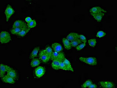 Scarb2 Polyclonal Antibody - image 5