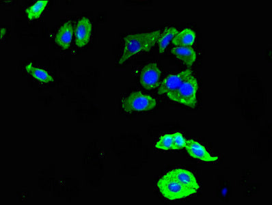 Ddr2 Polyclonal Antibody - image 4