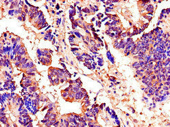 Immunofluorescent analysis of Hela cells using CAC07934 at dilution of 1:100 and Alexa Fluor 488-congugated AffiniPure Goat Anti-Rabbit IgG(H+L)