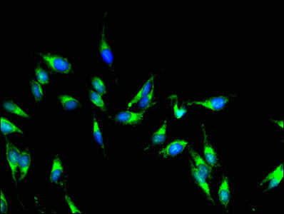 Western Blot; , Positive WB detected in Recombinant protein; , All lanes: AKAP9 antibody at 2.5µg/ml; , Secondary; , Goat polyclonal to rabbit IgG at 1/50000 dilution; , predicted band size: 44 kDa; , observed band size: 44 kDa