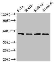 Immunohistochemistry of paraffin-embedded human thyroid tissue using CAC07953 at dilution of 1:100