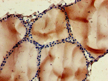 Immunohistochemistry of paraffin-embedded human placenta tissue using CAC07953 at dilution of 1:100