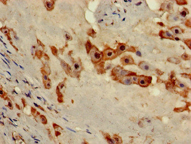 Immunofluorescent analysis of A549 cells using CAC07953 at dilution of 1:100 and Alexa Fluor 488-congugated AffiniPure Goat Anti-Rabbit IgG(H+L)