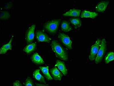 Nob1 Polyclonal Antibody - image 5