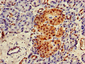 Immunohistochemistry of paraffin-embedded human skin tissue using CAC07954 at dilution of 1:100