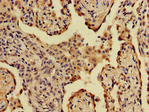 A2Ml1 Polyclonal Antibody - image 3