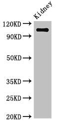 Immunohistochemistry of paraffin-embedded human kidney tissue using CAC07967 at dilution of 1:100