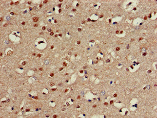 Chst1 Polyclonal Antibody - image 3