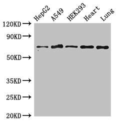 Immunohistochemistry of paraffin-embedded human spleen tissue using CAC07983 at dilution of 1:100