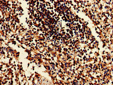 Immunohistochemistry of paraffin-embedded human testis tissue using CAC07983 at dilution of 1:100