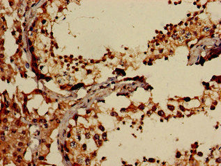 Immunofluorescent analysis of HepG2 cells using CAC07983 at dilution of 1:100 and Alexa Fluor 488-congugated AffiniPure Goat Anti-Rabbit IgG(H+L)