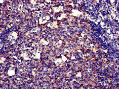 Immunofluorescent analysis of HepG2 cells using CAC08013 at dilution of 1:100 and Alexa Fluor 488-congugated AffiniPure Goat Anti-Rabbit IgG(H+L)