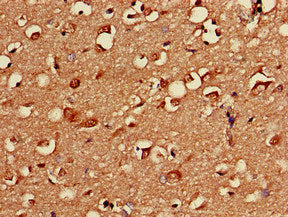 Immunohistochemistry of paraffin-embedded human kidney tissue using CAC08017 at dilution of 1:100