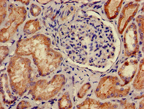 Immunofluorescent analysis of Hela cells using CAC08017 at dilution of 1:100 and Alexa Fluor 488-congugated AffiniPure Goat Anti-Rabbit IgG(H+L)