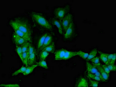 Prkacb Polyclonal Antibody - image 5