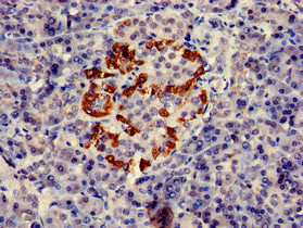Immunofluorescent analysis of Hela cells using CAC08024 at dilution of 1:100 and Alexa Fluor 488-congugated AffiniPure Goat Anti-Rabbit IgG(H+L)