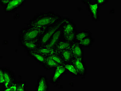 Ptf1A Polyclonal Antibody - image 4