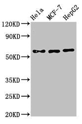 Immunohistochemistry of paraffin-embedded human liver cancer using CAC08040 at dilution of 1:100