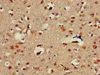 Alx1 Polyclonal Antibody - image 3