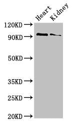 Immunohistochemistry of paraffin-embedded human liver tissue using CAC08064 at dilution of 1:100