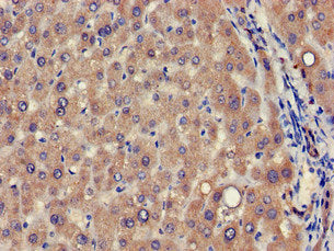 Immunofluorescent analysis of A549 cells using CAC08064 at dilution of 1:100 and Alexa Fluor 488-congugated AffiniPure Goat Anti-Rabbit IgG(H+L)