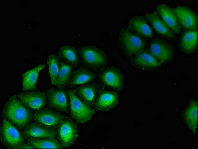 Western Blot; , Positive WB detected in: SH-SY5Y whole cell lysate; , All lanes: VPS39 antibody at 1:2000; , Secondary; , Goat polyclonal to rabbit IgG at 1/50000 dilution; , Predicted band size: 102, 101 kDa; , Observed band size: 102 kDa;