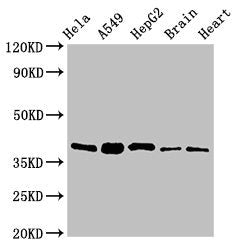 Immunohistochemistry of paraffin-embedded human ovarian cancer using CAC08065 at dilution of 1:100
