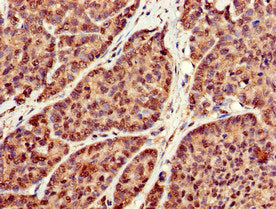 Immunohistochemistry of paraffin-embedded human lung tissue using CAC08065 at dilution of 1:100