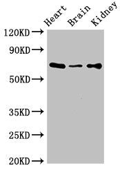 Immunohistochemistry of paraffin-embedded human testis tissue using CAC08086 at dilution of 1:100