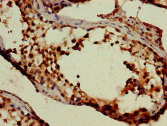 Immunohistochemistry of paraffin-embedded human kidney tissue using CAC08086 at dilution of 1:100
