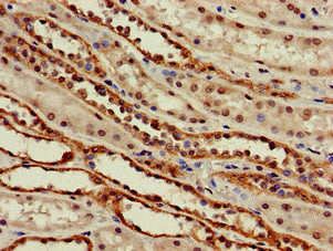 Immunofluorescent analysis of A549 cells using CAC08086 at dilution of 1:100 and Alexa Fluor 488-congugated AffiniPure Goat Anti-Rabbit IgG(H+L)