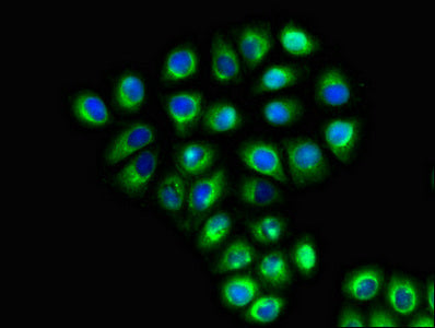Slc6A13 Polyclonal Antibody - image 5