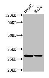 Immunohistochemistry of paraffin-embedded human adrenal gland tissue using CAC08087 at dilution of 1:100