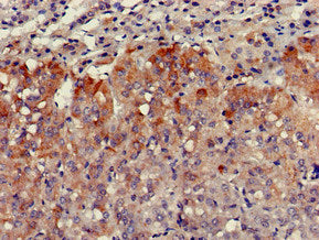 Immunofluorescent analysis of PC-3 cells using CAC08087 at dilution of 1:100 and Alexa Fluor 488-congugated AffiniPure Goat Anti-Rabbit IgG(H+L)