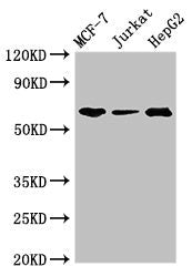 Immunohistochemistry of paraffin-embedded human lung tissue using CAC08088 at dilution of 1:100