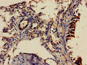 Immunohistochemistry of paraffin-embedded human brain tissue using CAC08088 at dilution of 1:100