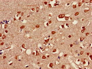 Immunofluorescent analysis of Hela cells using CAC08088 at dilution of 1:100 and Alexa Fluor 488-congugated AffiniPure Goat Anti-Rabbit IgG(H+L)