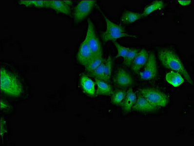 Shoc2 Polyclonal Antibody - image 5