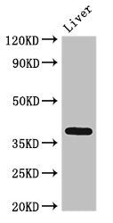 Immunohistochemistry of paraffin-embedded human cervical cancer using CAC08092 at dilution of 1:100