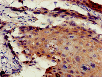 Etv7 Polyclonal Antibody - image 3