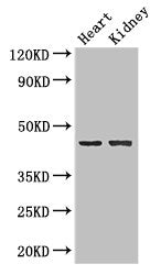 Western Blot; , Positive WB detected in: MCF-7 whole cell lysate, Mouse Liver tissue, Mouse Kidney tissue; , All lanes: NRXN1 antibody at 1:2000; , Secondary; , Goat polyclonal to rabbit IgG at 1/50000 dilution; , Predicted band size: 47 kDa; , Observed band size: 47 kDa;