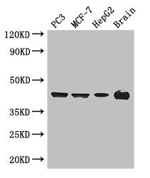 Immunofluorescent analysis of Hela cells using CAC08104 at dilution of 1:100 and Alexa Fluor 488-congugated AffiniPure Goat Anti-Rabbit IgG(H+L)