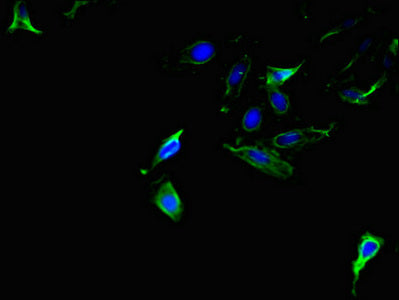 Amacr Polyclonal Antibody - image 3