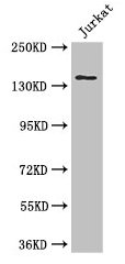 Immunofluorescent analysis of HepG2 cells using CAC08114 at dilution of 1:100 and Alexa Fluor 488-congugated AffiniPure Goat Anti-Rabbit IgG(H+L)