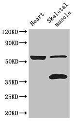 Immunofluorescent analysis of HepG2 cells using CAC08116 at dilution of 1:100 and Alexa Fluor 488-congugated AffiniPure Goat Anti-Rabbit IgG(H+L)