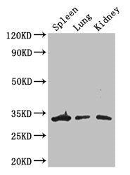 Immunofluorescent analysis of HepG2 cells using CAC08118 at dilution of 1:100 and Alexa Fluor 488-congugated AffiniPure Goat Anti-Rabbit IgG(H+L)