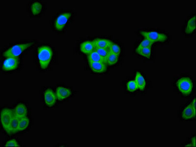 Alkbh4 Polyclonal Antibody - image 3